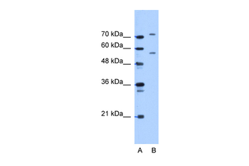 JPH1 Rabbit Polyclonal Antibody