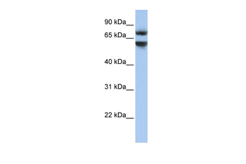 JPH3 Rabbit Polyclonal Antibody