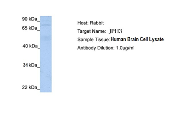 JPH3 Rabbit Polyclonal Antibody