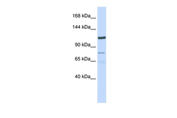 KIAA1324 Rabbit Polyclonal Antibody