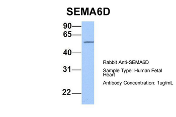 SEMA6D Rabbit Polyclonal Antibody