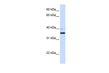 B3GALT1 Rabbit Polyclonal Antibody