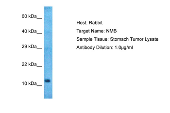 NMB Rabbit Polyclonal Antibody