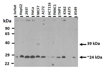 RTN1 Rabbit Polyclonal Antibody