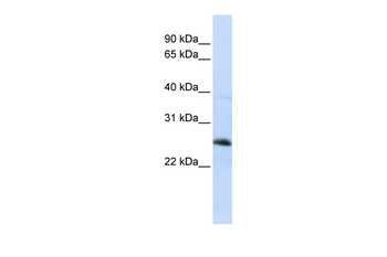 RTN1 Rabbit Polyclonal Antibody