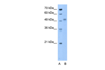 ZP4 Rabbit Polyclonal Antibody