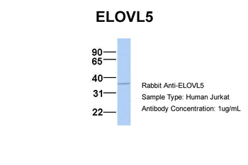 ELOVL5 Rabbit Polyclonal Antibody