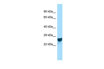 Ccdc90b Rabbit Polyclonal Antibody