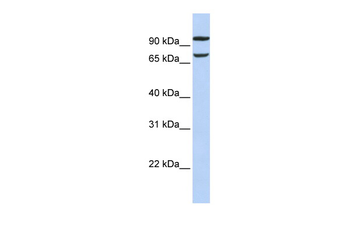 FAM38B Rabbit Polyclonal Antibody