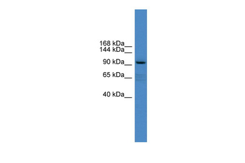 XYLT1 Rabbit Polyclonal Antibody