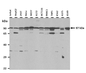 XYLT2 Rabbit Polyclonal Antibody