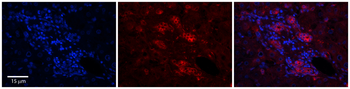 C11orf24 Rabbit Polyclonal Antibody