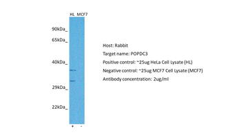 POPDC3 Rabbit Polyclonal Antibody