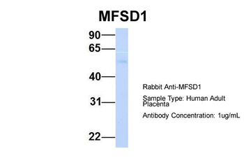 MFSD1 Rabbit Polyclonal Antibody