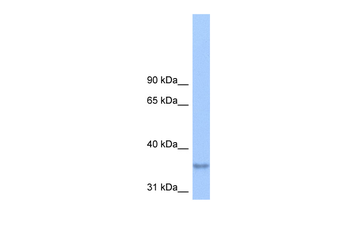 PLPPR2 Rabbit Polyclonal Antibody