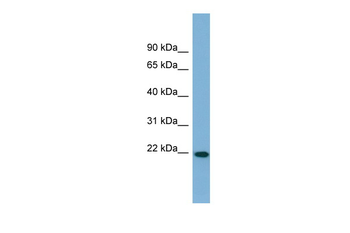 FNDC4 Rabbit Polyclonal Antibody