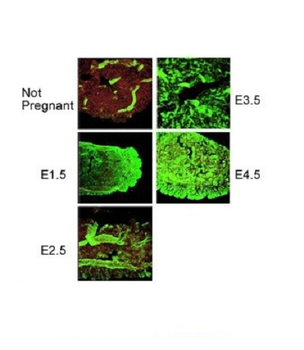 PORCN Rabbit Polyclonal Antibody