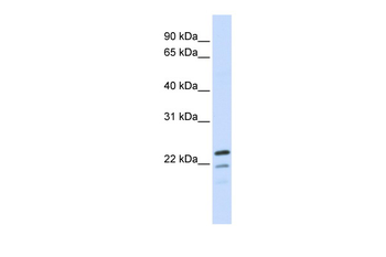 REEP1 Rabbit Polyclonal Antibody