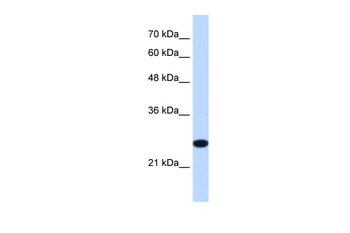 TMEM109 Rabbit Polyclonal Antibody