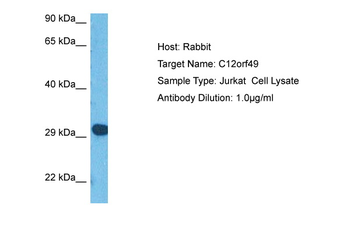 C12orf49 Rabbit Polyclonal Antibody