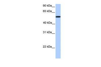 UGT2A3 Rabbit Polyclonal Antibody