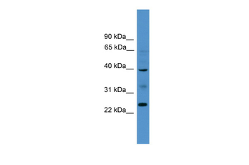 BTNL8 Rabbit Polyclonal Antibody