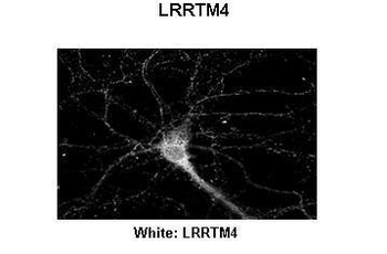 LRRTM4 Rabbit Polyclonal Antibody