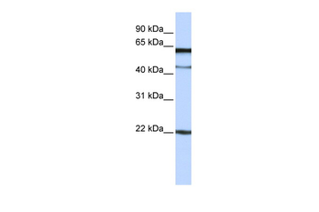 MPIG6B Rabbit Polyclonal Antibody