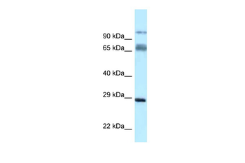 Prrt1 Rabbit Polyclonal Antibody