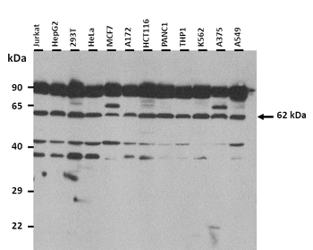 CLPTM1L Rabbit Polyclonal Antibody