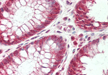 CLPTM1L Rabbit Polyclonal Antibody
