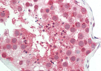 CLPTM1L Rabbit Polyclonal Antibody