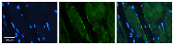 CLPTM1L Rabbit Polyclonal Antibody