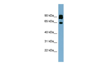 CLPTM1L Rabbit Polyclonal Antibody