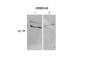 CRISPLD2 Rabbit Polyclonal Antibody