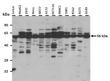 CRISPLD2 Rabbit Polyclonal Antibody