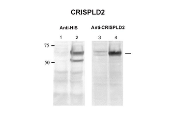 CRISPLD2 Rabbit Polyclonal Antibody