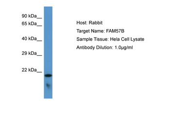 FAM57B Rabbit Polyclonal Antibody