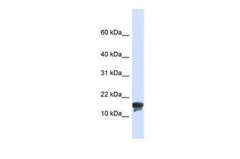 TMEM166 Rabbit Polyclonal Antibody