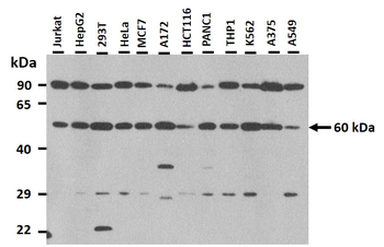 MFSD2A Rabbit Polyclonal Antibody