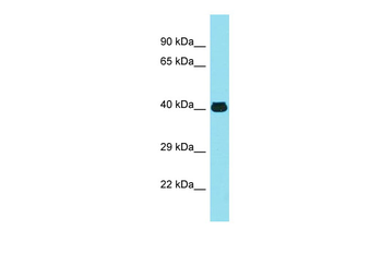 MFSD2A Rabbit Polyclonal Antibody
