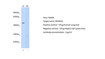 MFSD2A Rabbit Polyclonal Antibody