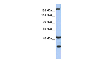 DISP1 Rabbit Polyclonal Antibody