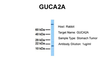 GUCA2A Rabbit Polyclonal Antibody