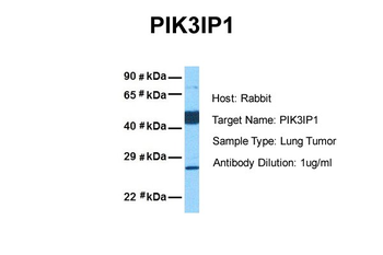 PIK3IP1 Rabbit Polyclonal Antibody