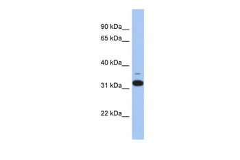 ANTXR2 Rabbit Polyclonal Antibody