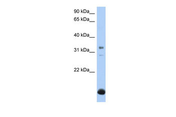 B3GALT6 Rabbit Polyclonal Antibody