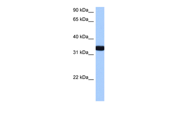 GIMAP1 Rabbit Polyclonal Antibody