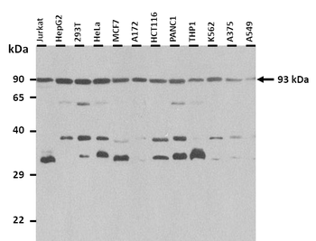 UNC5A Rabbit Polyclonal Antibody