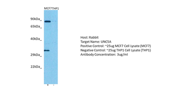 UNC5A Rabbit Polyclonal Antibody